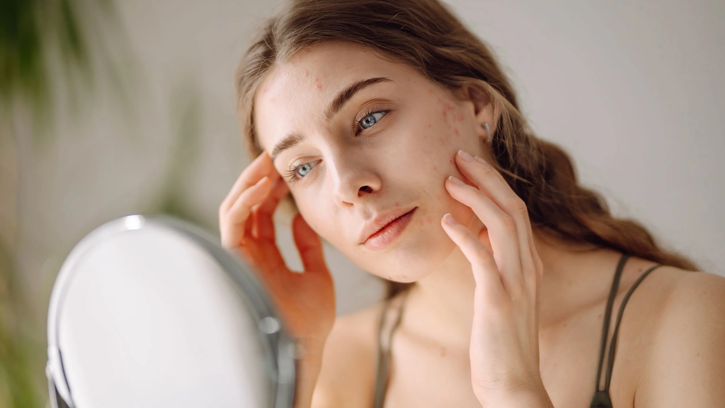 Understanding Eczema: A Friendly Guide to Your Skin